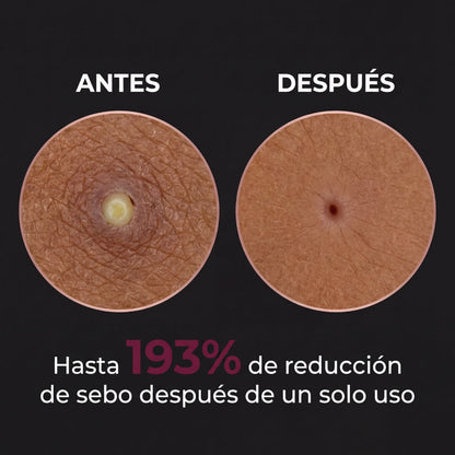 Renace Pro™