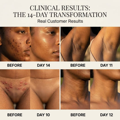 Body Dark Spot Bar (Underarms, Knees & Inner Thighs)