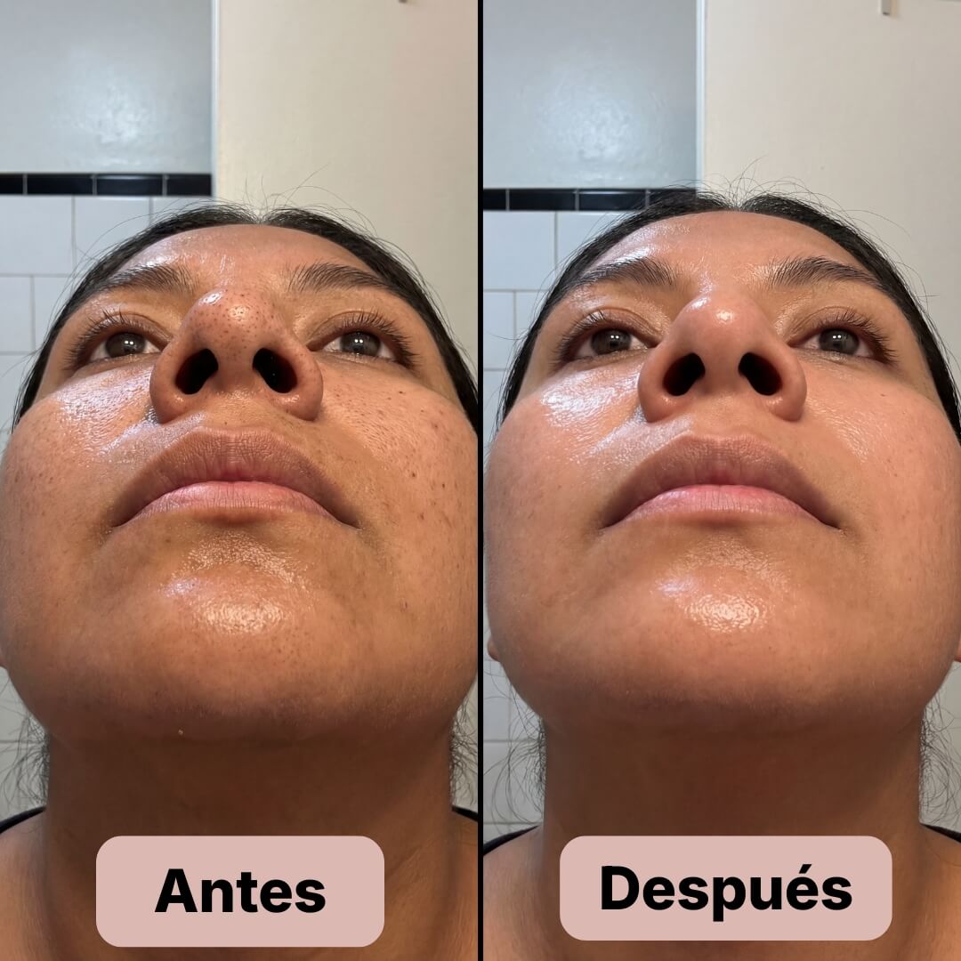 Renace Pro™