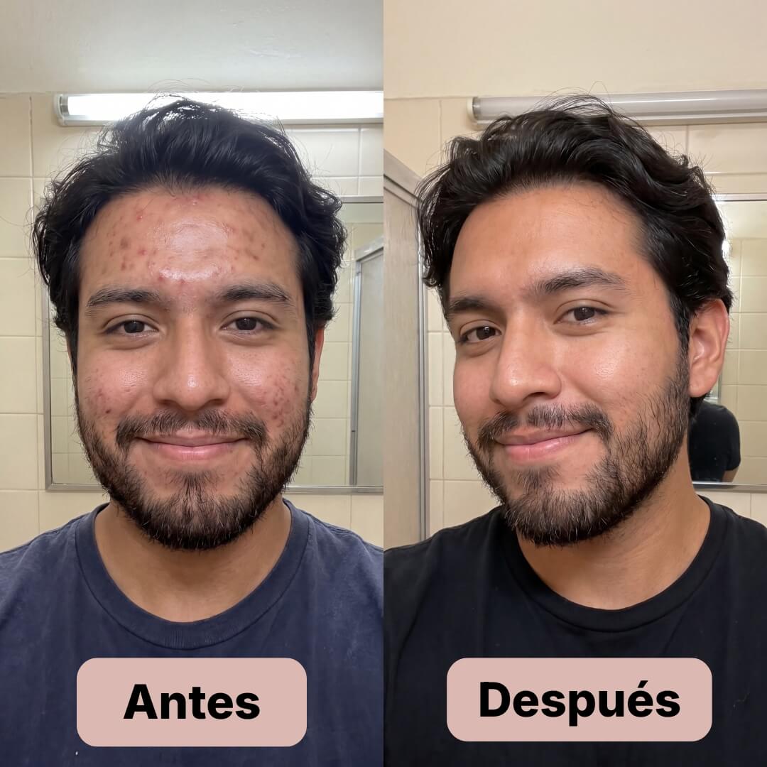 Renace Pro™
